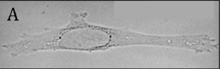 <p>Type of light microscopy that uses a bright background to observe specimens with high contrast such as stained samples</p>