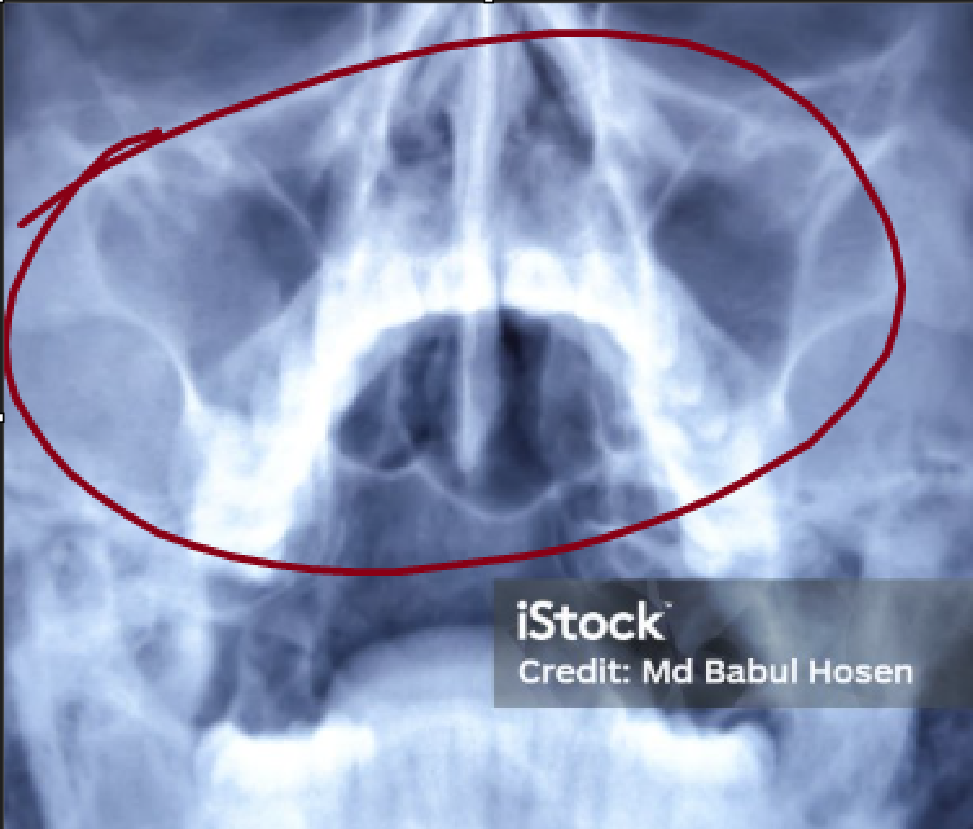 <p>what is this, its description and its appearance on images</p>