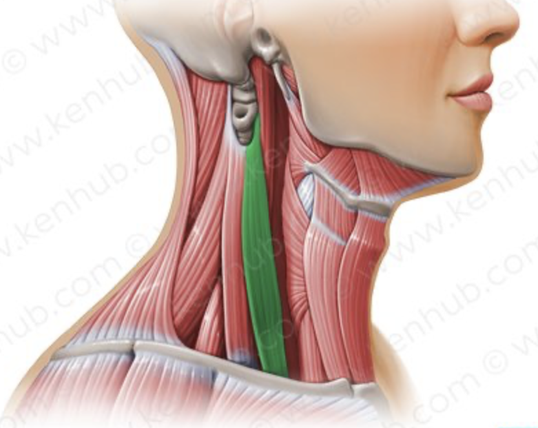 <p>in between sternocleidomastoid (make a triangle shape and are separated by veins)</p>