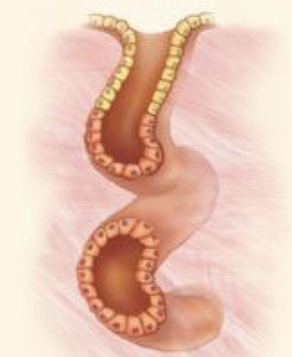 <p>What gland duct type is this?</p>