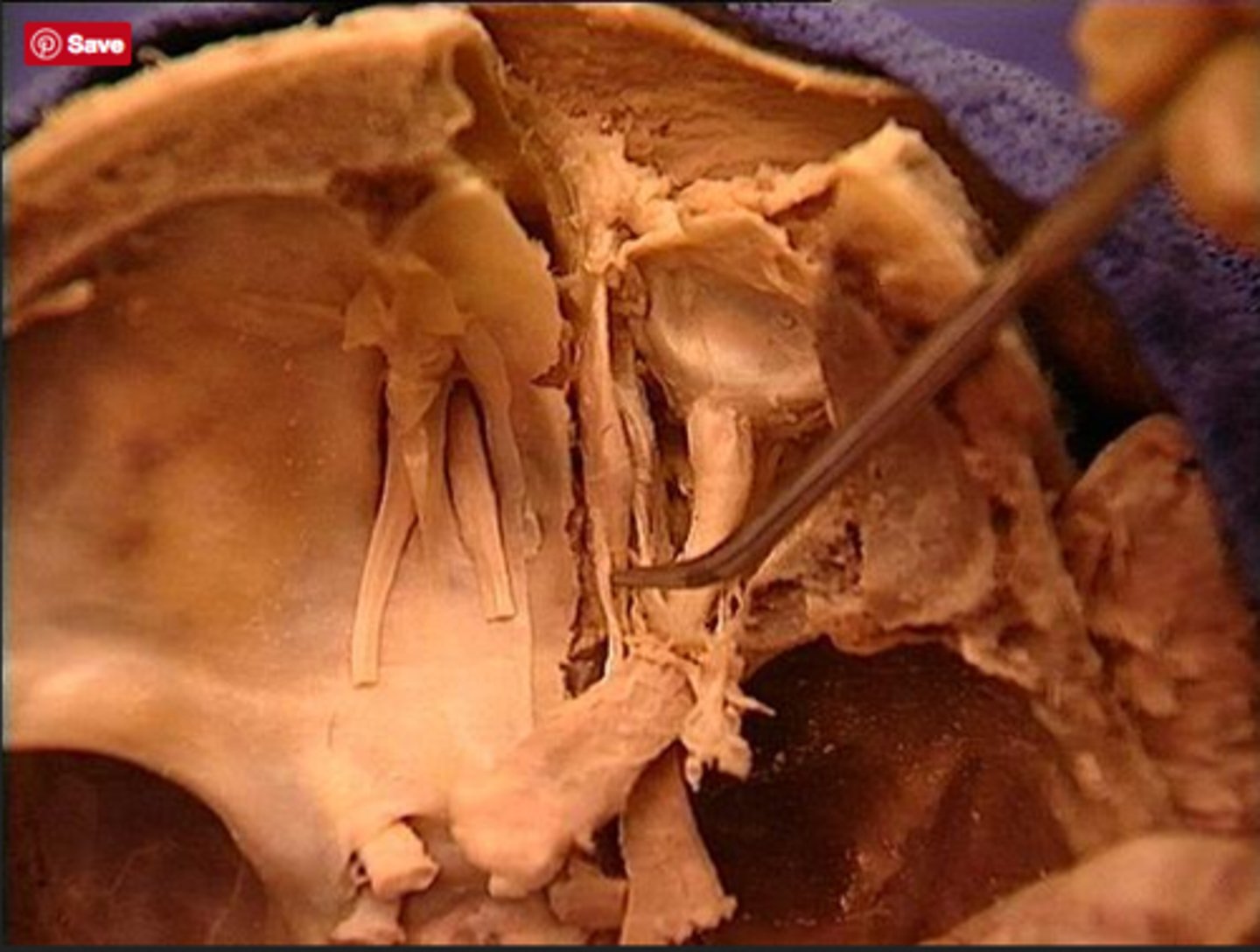 <p>innervates superior oblique</p>
