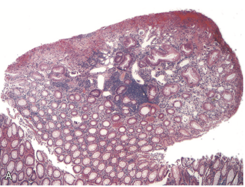 term image