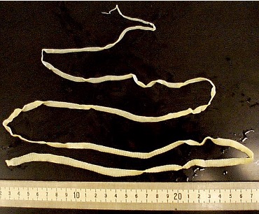 <p>•Tapeworms</p><p>•Internal parasites</p><p>•No digestive system (?)</p><p>•Attaches to the host via a scolex</p><p>•Shed Proglottids when mature</p><p>Platyhelminthes</p><p></p>