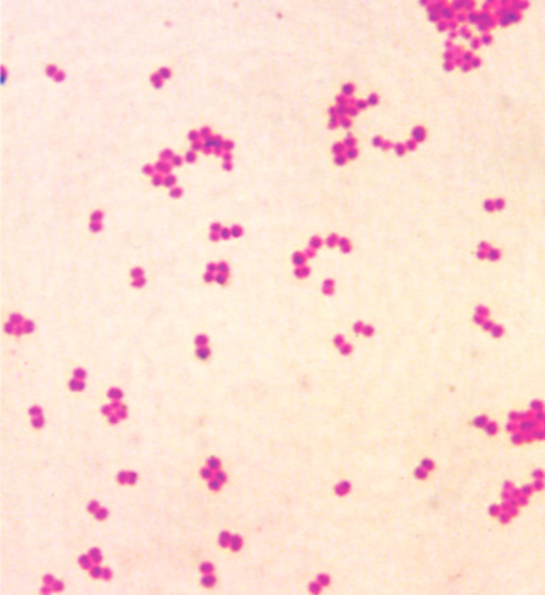 <p>Neisseria gonorrhoeae</p>