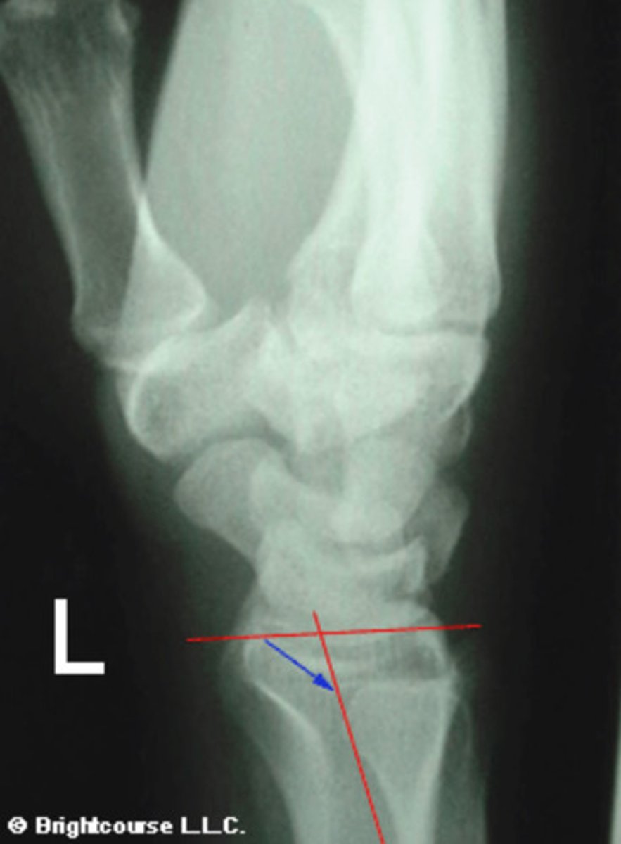 <p>What angle is being assessed in this image?</p>