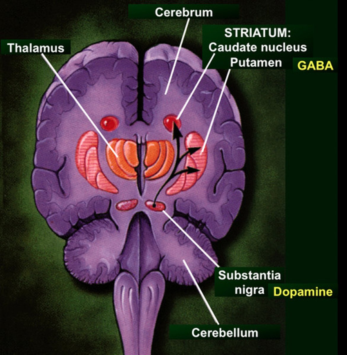 <p>Parkinson's disease results from the degeneration of neurons within the Substantia nigra that secrete the neurotransmitter known as ______________ at the basal nuclei.</p>