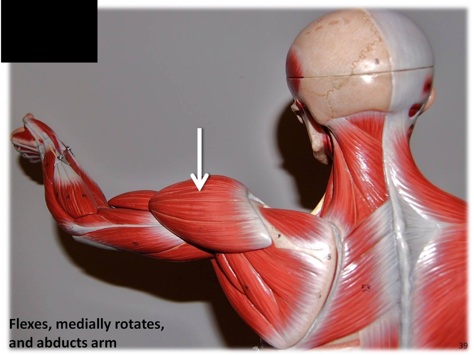 <p>What muscle is this?*****</p>