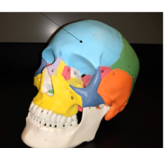 <p>What bone is this</p>