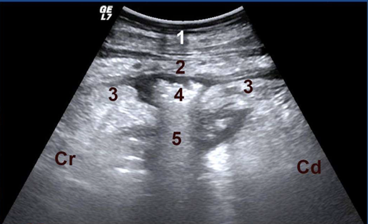 <p>What type of ulcer is this?</p>