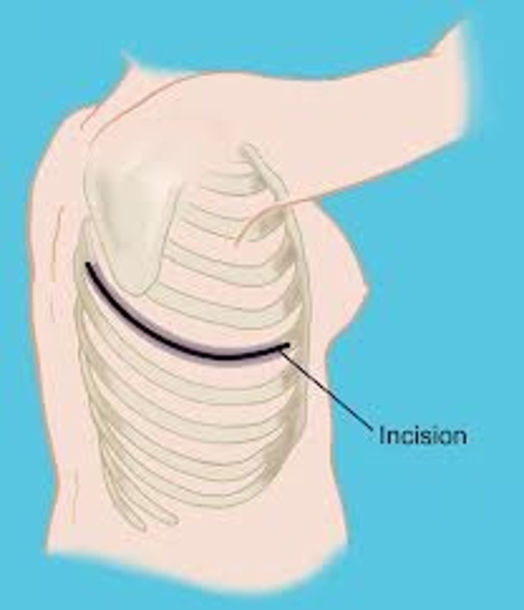 <p>Extends from T4 medial to scapula to anterior axilla at 5/6th intercostal space</p>