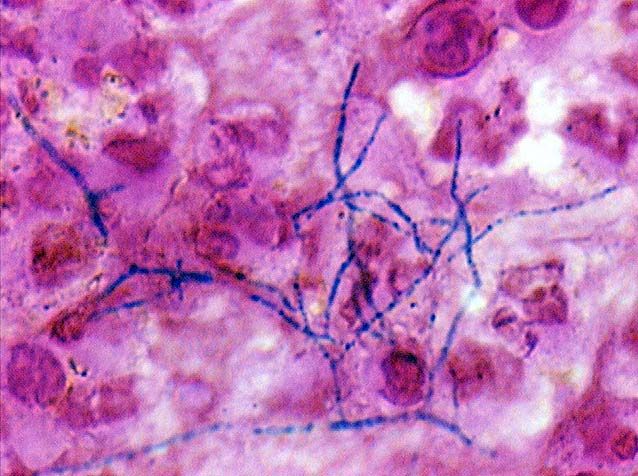 <p>What am i- gram stain, shape, arrangement</p>