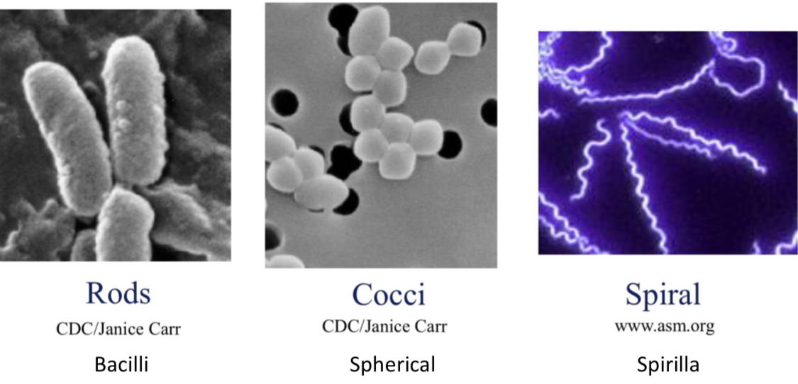 <ol><li><p>Rods - bacilli or diplobaccilli (2 rods)</p></li><li><p>Cocci - spherical, dipolococci (2 spheres)</p></li><li><p>Spiral - spirilla</p></li></ol><p></p>