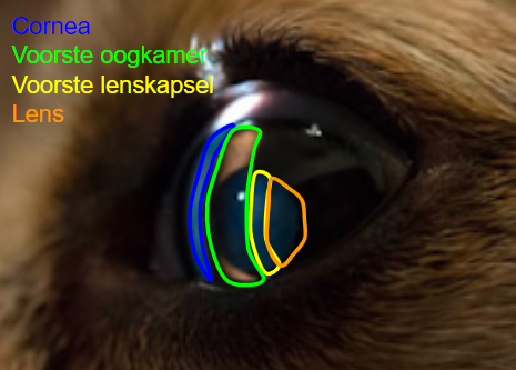 <p>Bekijk deze onderdelen met een spleetlamp op de hoogste helderheid in een verduisterde ruimte.</p><p></p><p><strong>Voorste oogkamer</strong></p><ul><li><p>Vorm en diepte</p></li><li><p>Helderheid</p></li></ul><p></p><p><strong>Pupil</strong></p><ul><li><p>Vorm</p></li><li><p>Stand</p></li></ul><p></p><p>Pupilreflex</p><ol><li><p>Met penlamp in het oog schijnen</p></li><li><p>Pupil wordt vlot kleiner</p></li><li><p>Is de pupil van het andere oog ook klein?</p></li></ol><p></p><p><strong>Iris</strong></p><ul><li><p>Kleur</p></li><li><p>Gladheid</p></li><li><p>Dikte</p></li><li><p>Defecten</p></li><li><p>Embryonale resten</p></li><li><p>Stand en evt. bewegingen (iridodonesis)</p></li><li><p>Transilluminatie</p></li></ul><p></p><p><strong>Achterste oogkamer</strong></p><p>Aanwezigheid van:</p><ul><li><p>Cystes</p></li><li><p>Neoplasie</p></li></ul><p></p><p><strong>Lens</strong></p><ul><li><p>Helderheid (spleetlamp)</p><ol><li><p>Felle spleetvormige lichtbundel vanuit verschillende richtingen in het oog schijnen</p></li><li><p>Cornea → voorste oogkamer → voorste lenskapsel → lens</p></li></ol></li><li><p>Grootte en vorm</p></li><li><p>Stilstand of bewegend (lentidonesis)</p></li><li><p>Plaats</p></li></ul><p></p><p><strong>Corpus vitreum (glasvocht)</strong></p><ul><li><p>Helderheid</p></li></ul>