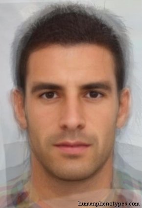 <p>Identify this Phenotype</p>