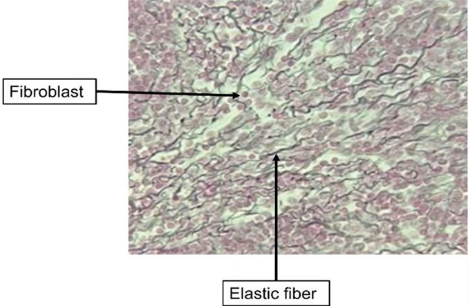 <p>What tissue is shown </p>