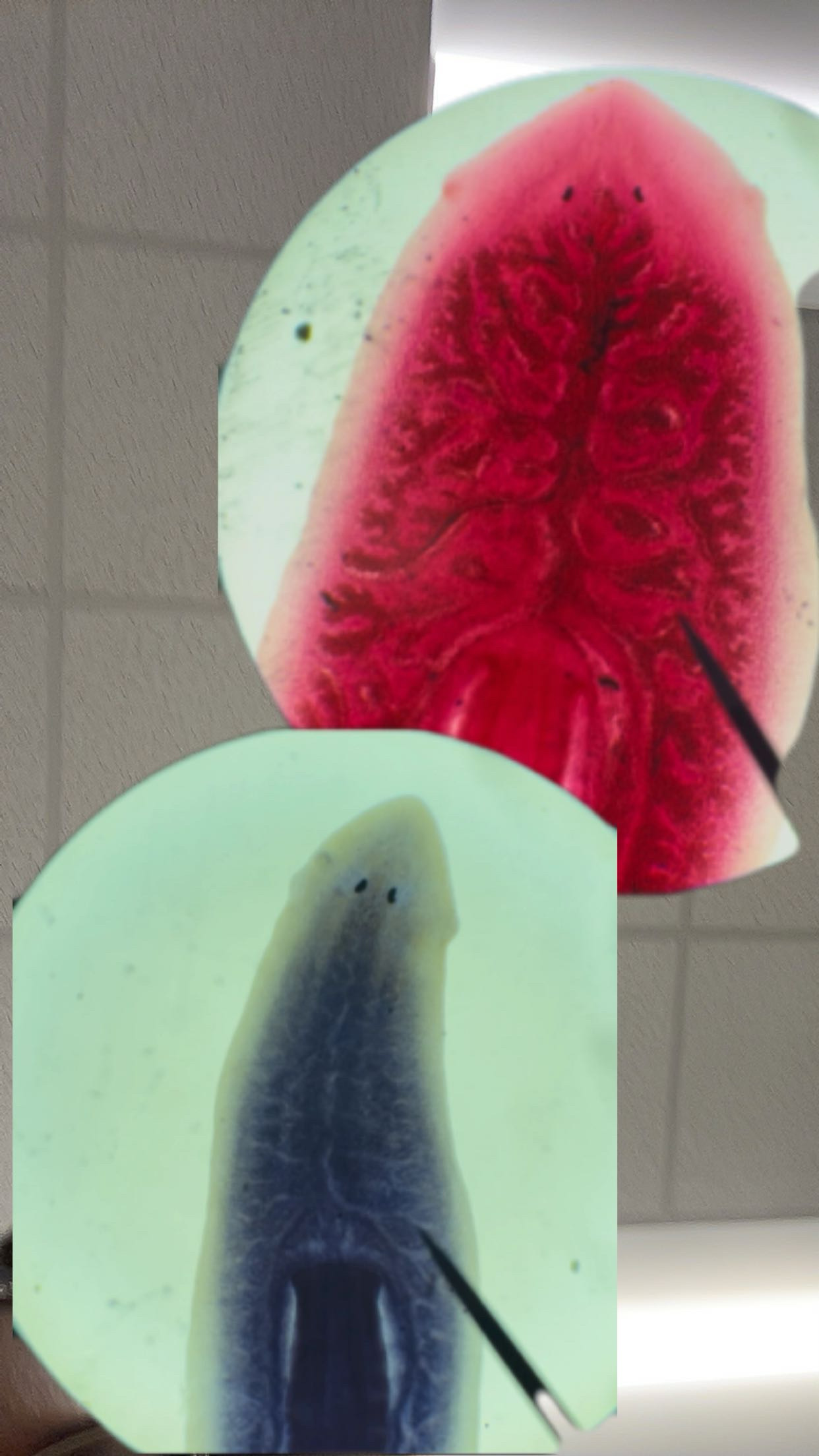 <p>Identify the organism and the Class it belongs to</p>