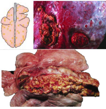 <p>What pattern of lung pathology? Describe appearance and pathogenesis. Example cause (cattle)</p>