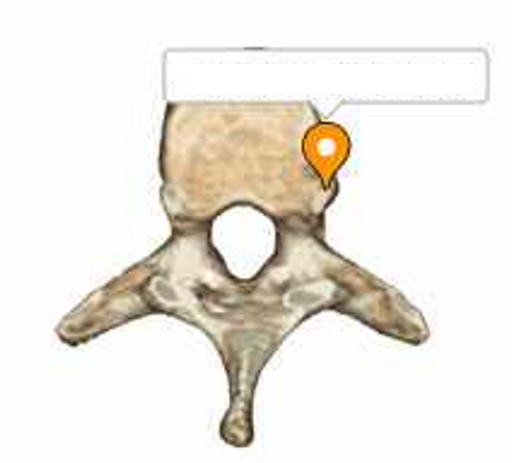 <p>ID bony features</p>