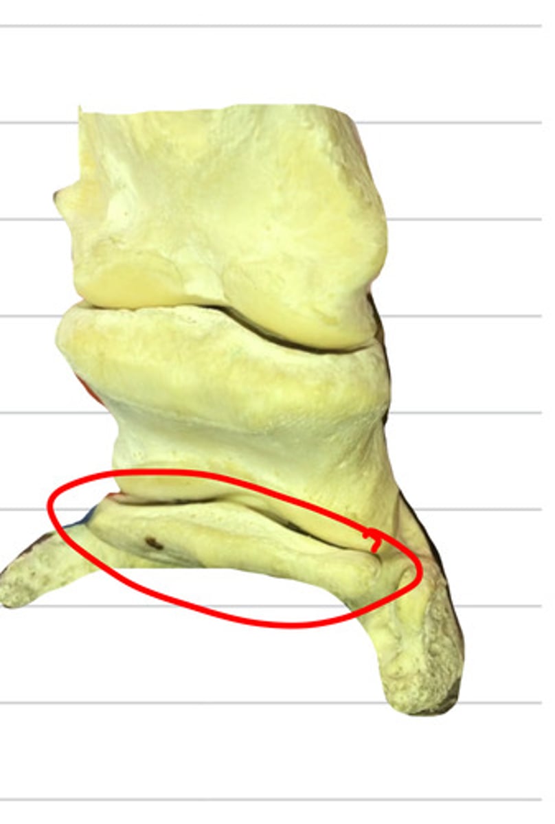 <p>which is this bone?</p>