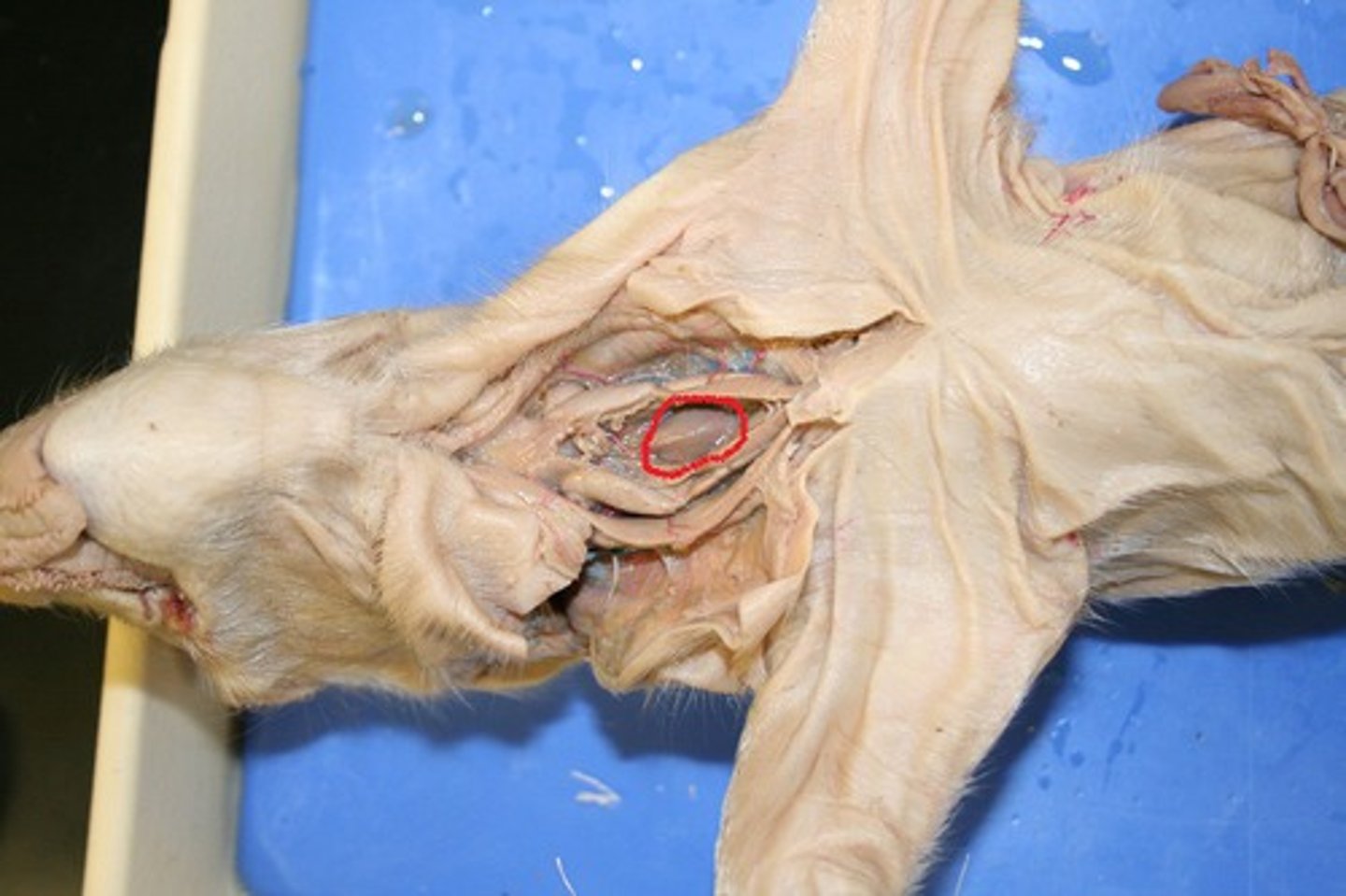 <p>What system does the Thyroid Gland belong to?</p>