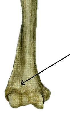 <p>Identify if this is an anterior or posterior view and if it is a right or left.</p>