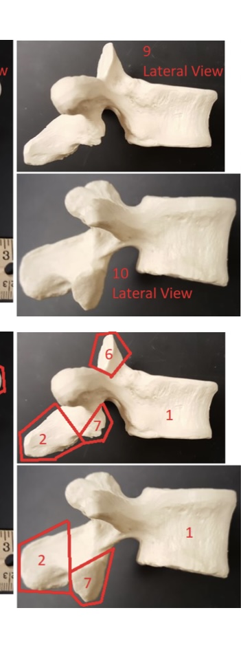 <p>7) name these bumps</p>