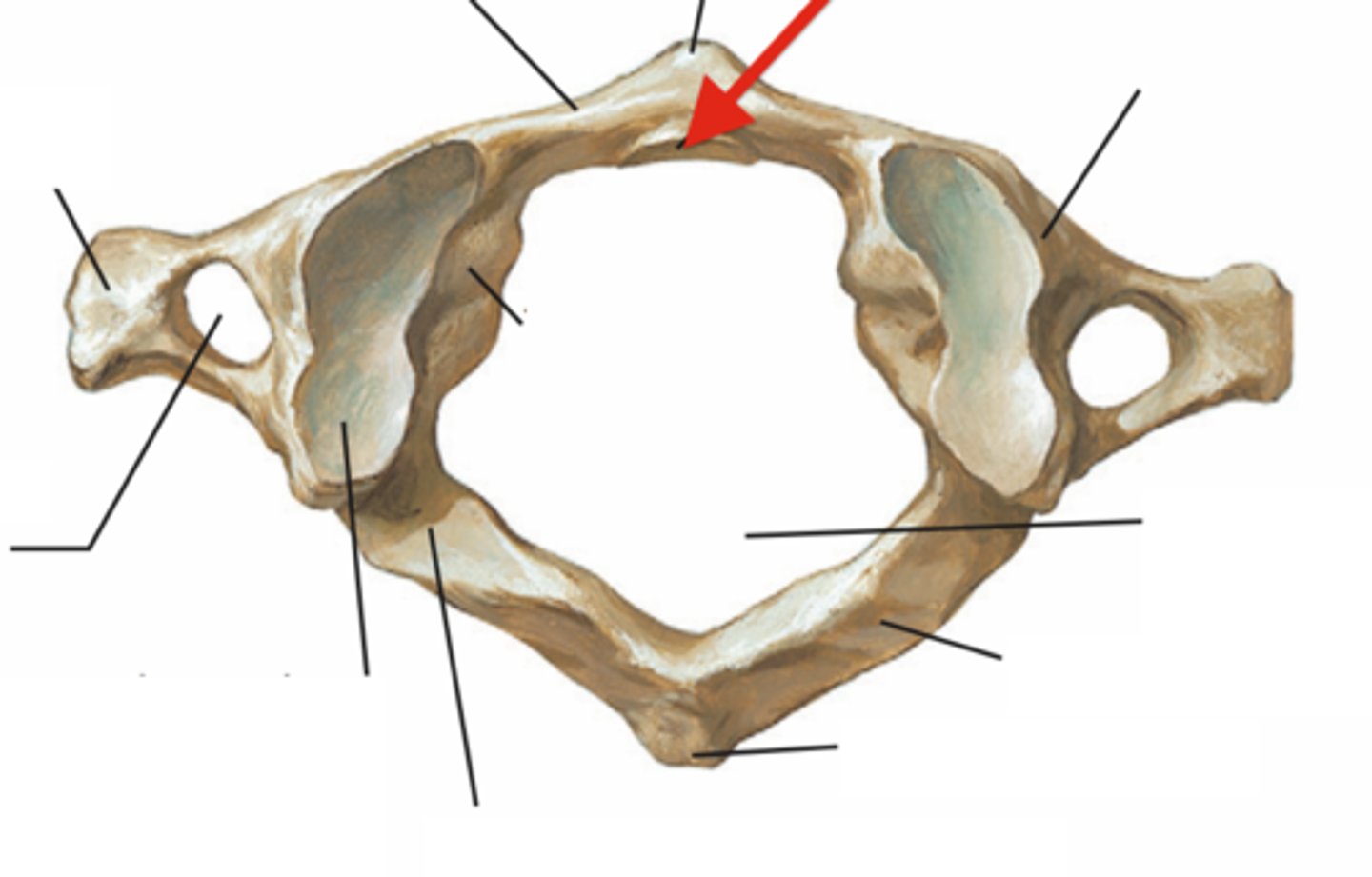 <p>Name this specific part of the atlas (C1).</p>
