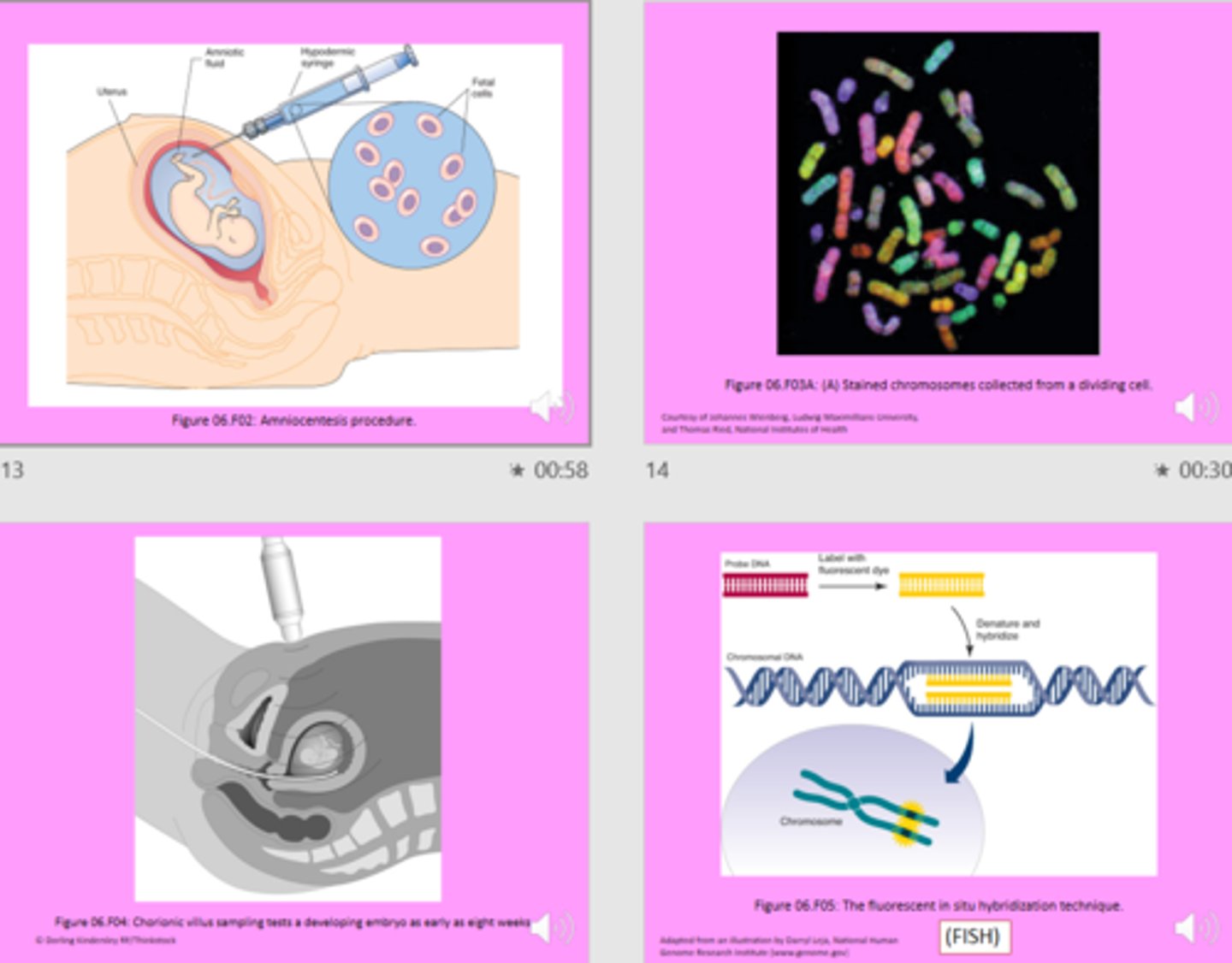 <p>1. Amniocentesis - the testing/treatment of amniotic fluid</p><p>2. Chorionic Villus sampling</p><p>3. FISH</p>