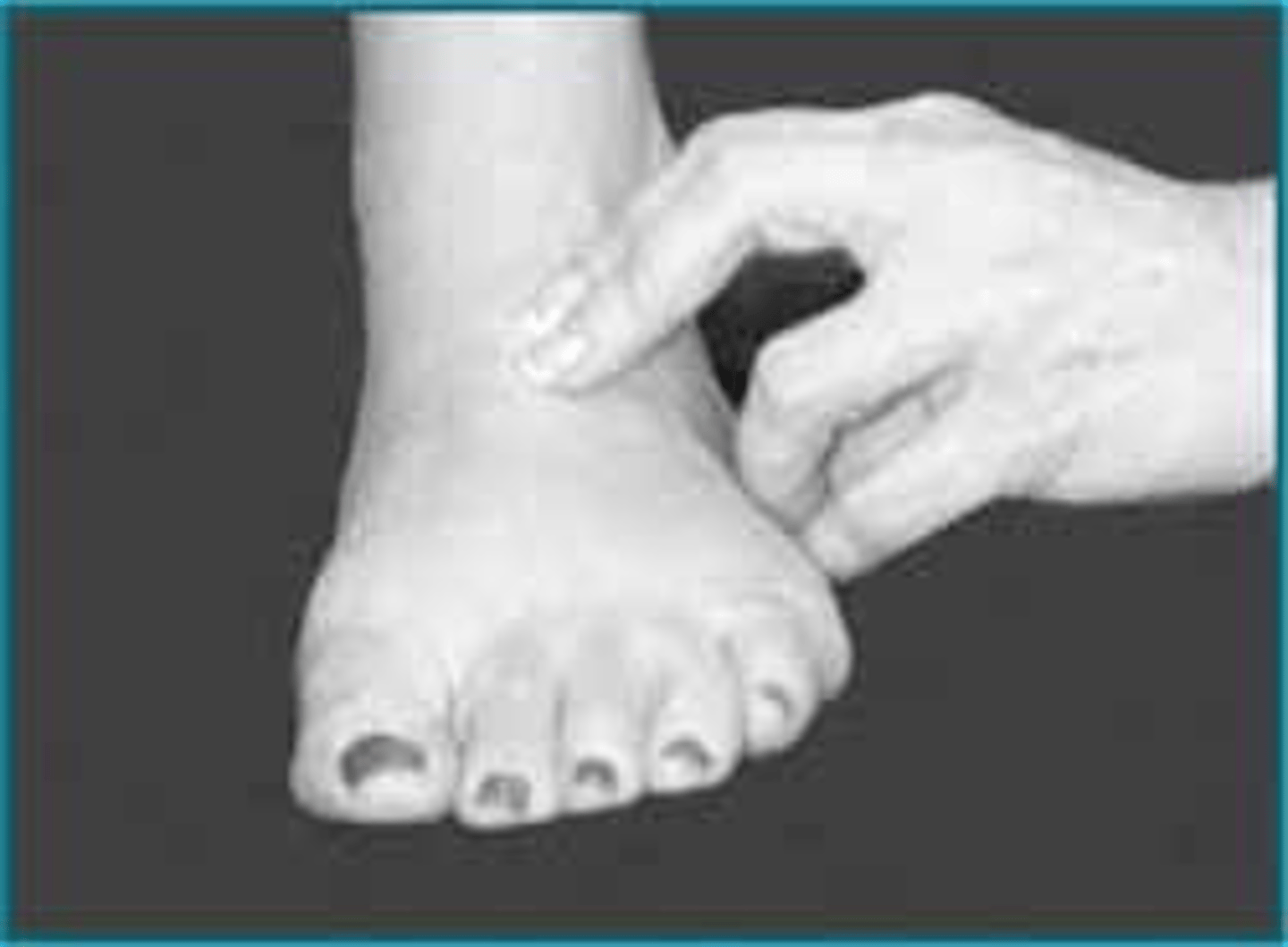 <p>pulse felt across the arch of the foot, slightly lateral to the midline, beside the extensor tendon of the great toe.</p><p>used to evaluate circulation of the leg, not necessarily to palpate pulse rate.</p>