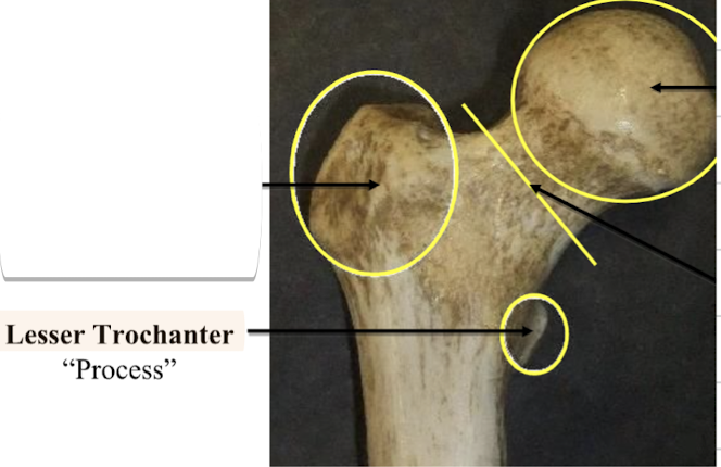 <p>Lesser trochanter </p>