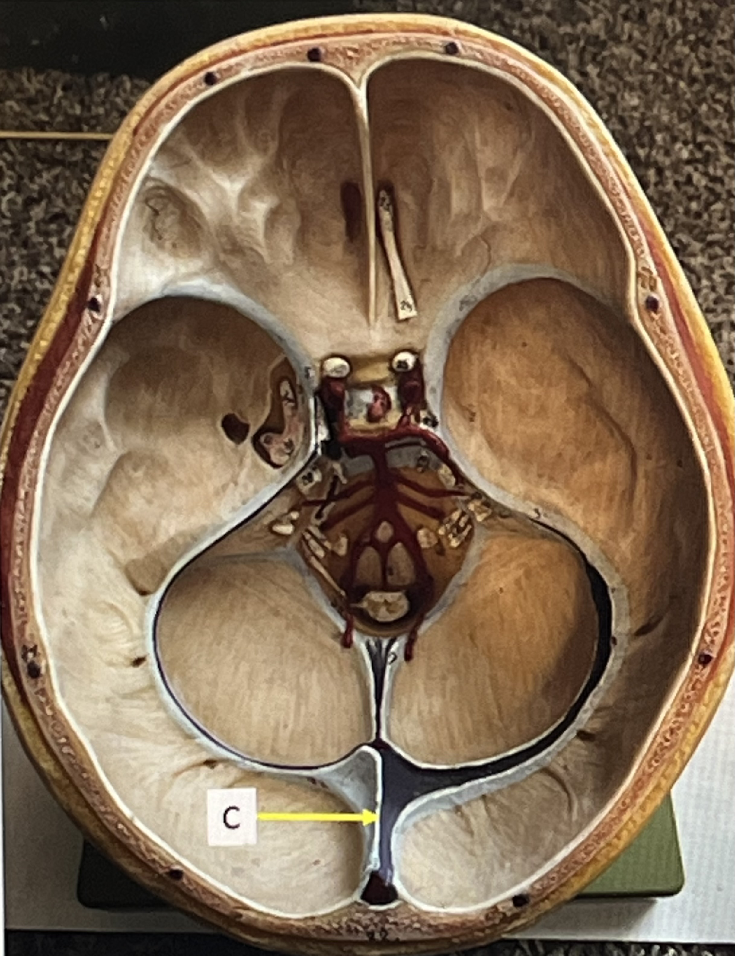 <p>dura mater folds: falx cerebelli</p>