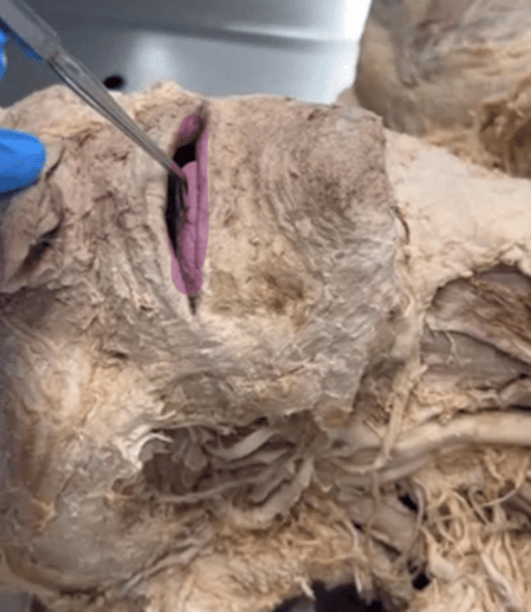 <p>Name the cavity.</p>