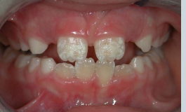 <p>what is shown here?</p>