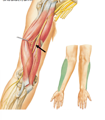 <p>Musculocutaneous Nerve</p>