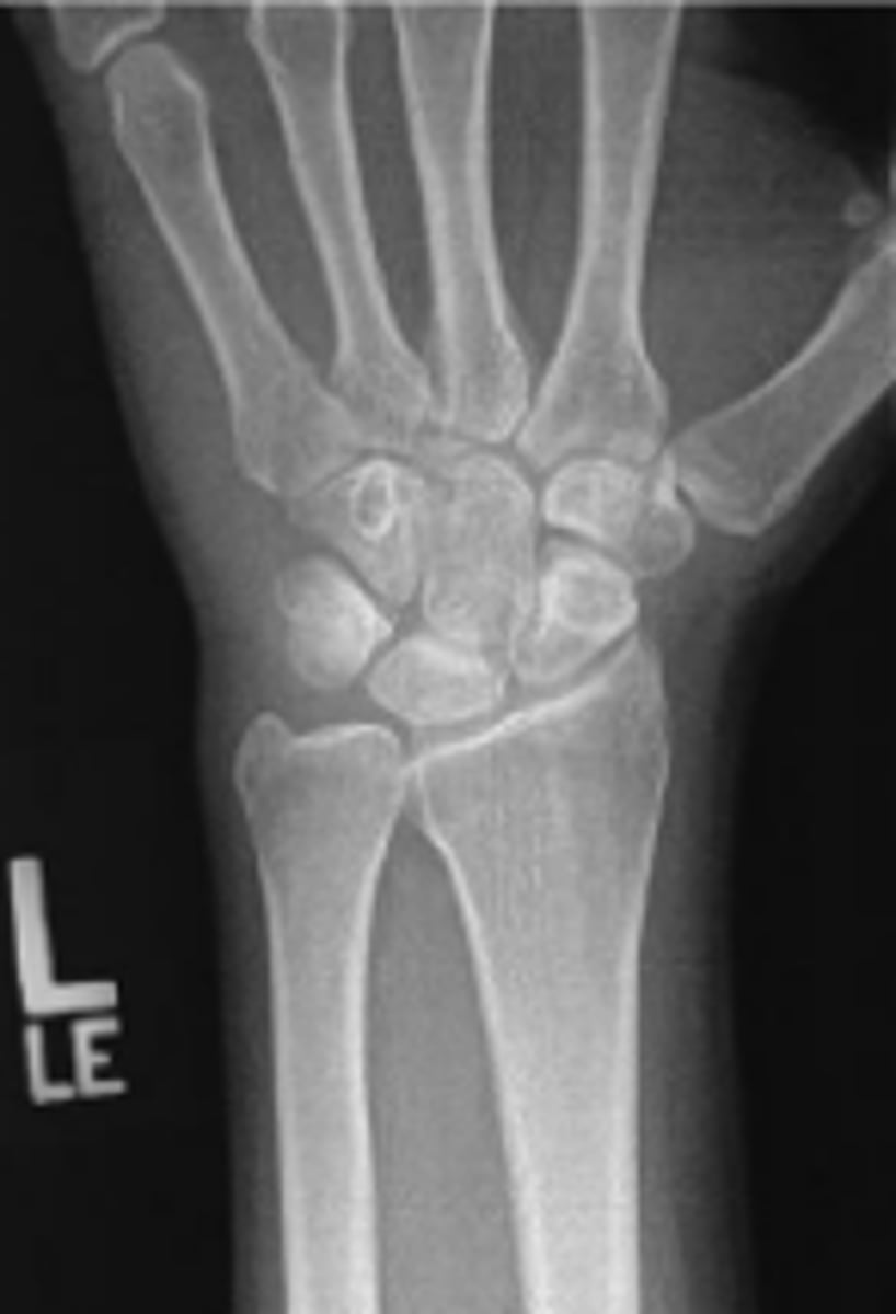 <p>What is the name of the radiographic view?</p>