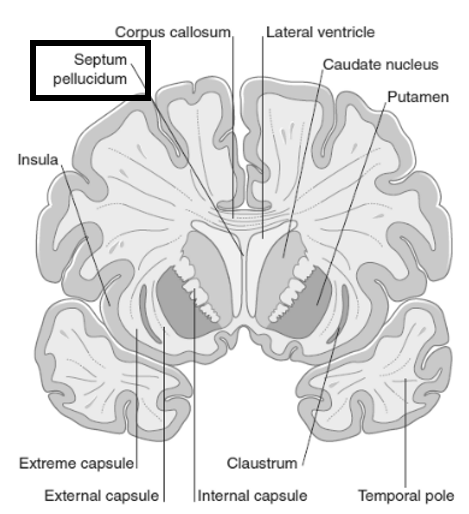 <p>Deel van limbisch systeem</p><p>= Dubbel verticaal membraan dat anterieure hoors van laterale ventrikels scheidt</p>
