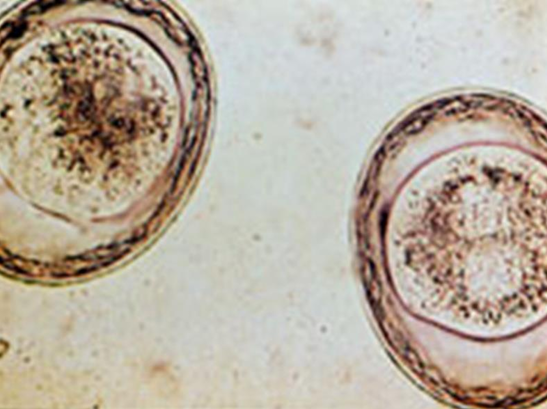 <ol><li><p>SN</p></li><li><p>PS</p></li><li><p>DH</p></li><li><p>Anterior end Appearance</p></li></ol><p></p>