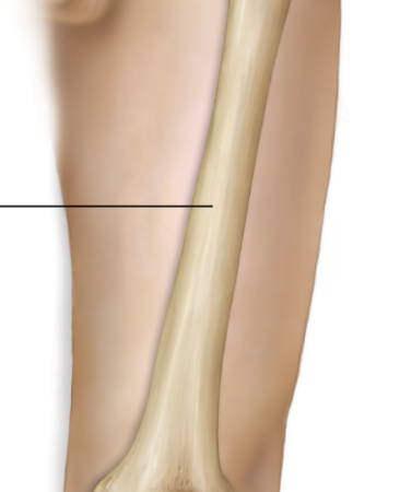 <p>longest and strongest bone in the body; has two processes; articulates with tibia</p>