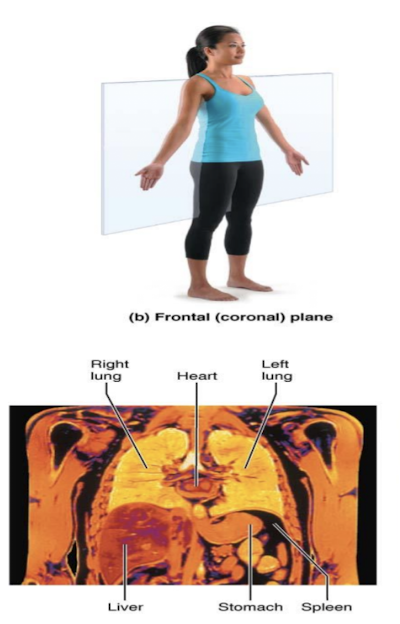 <p>Frontal (coronal) plane</p>