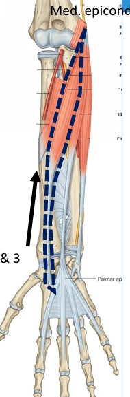 <p>Name this muscle </p>