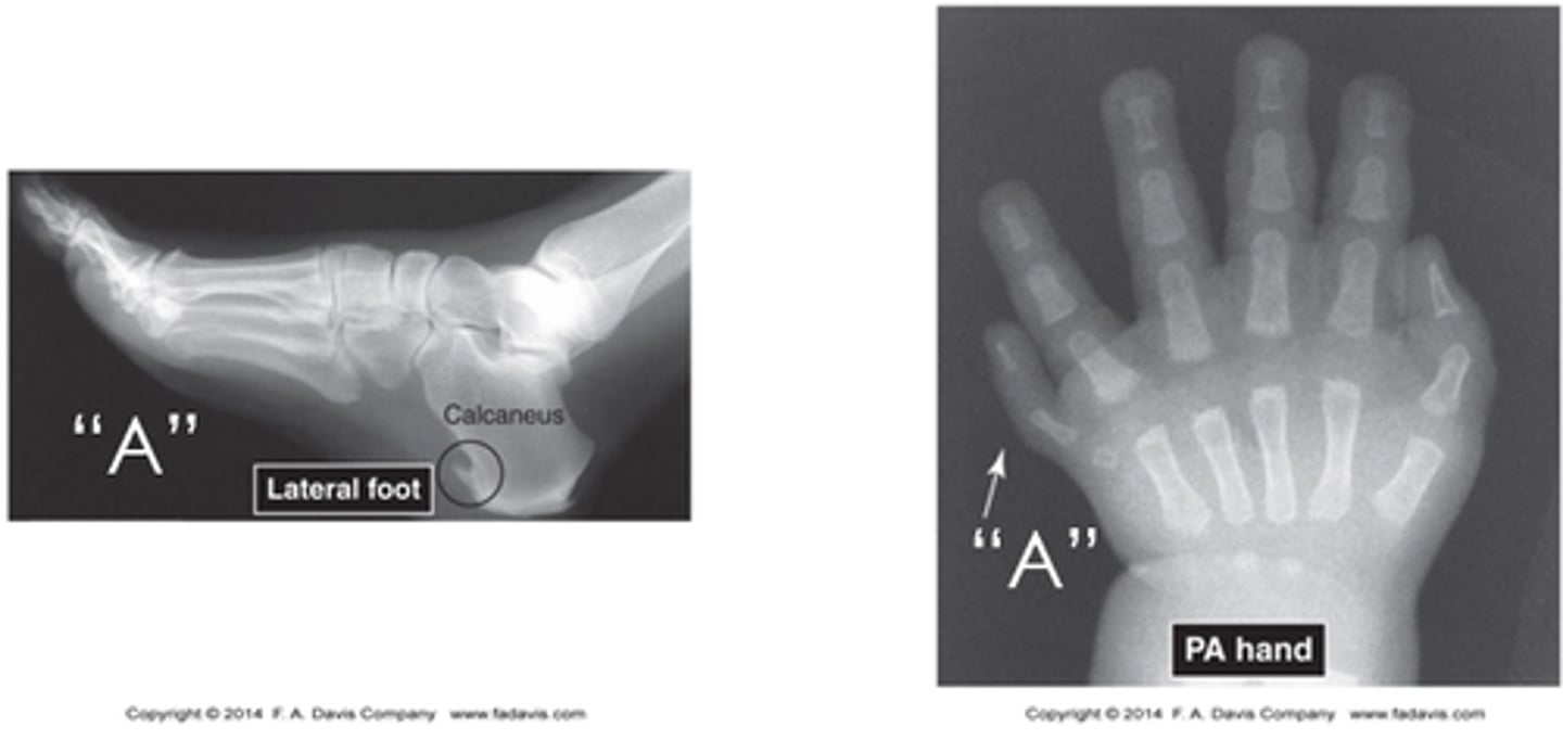 <p>General Skeletal Architecture</p><p>- Gross size, appearance and number of bones</p><p>General Contour of Bone</p><p>- Normal shape and contour</p><p>Alignment of Bones to adjacent Bones</p><p>- Normal joint articulation and spatial relationship</p>