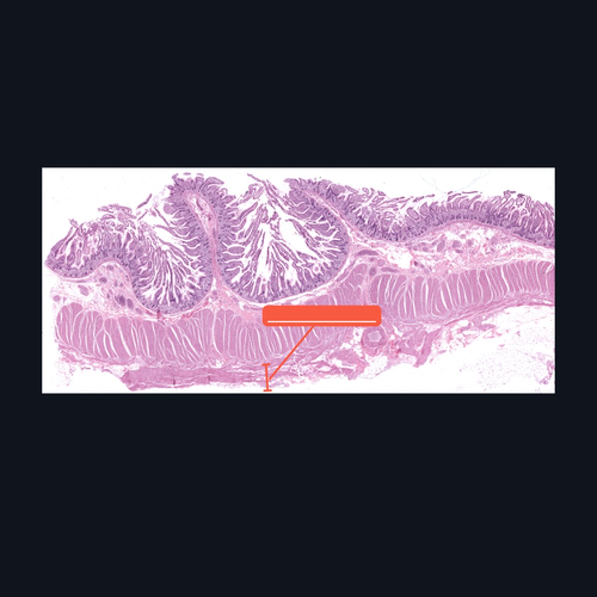 <p>Identify the pointed histologic layer of the digestive tract</p>
