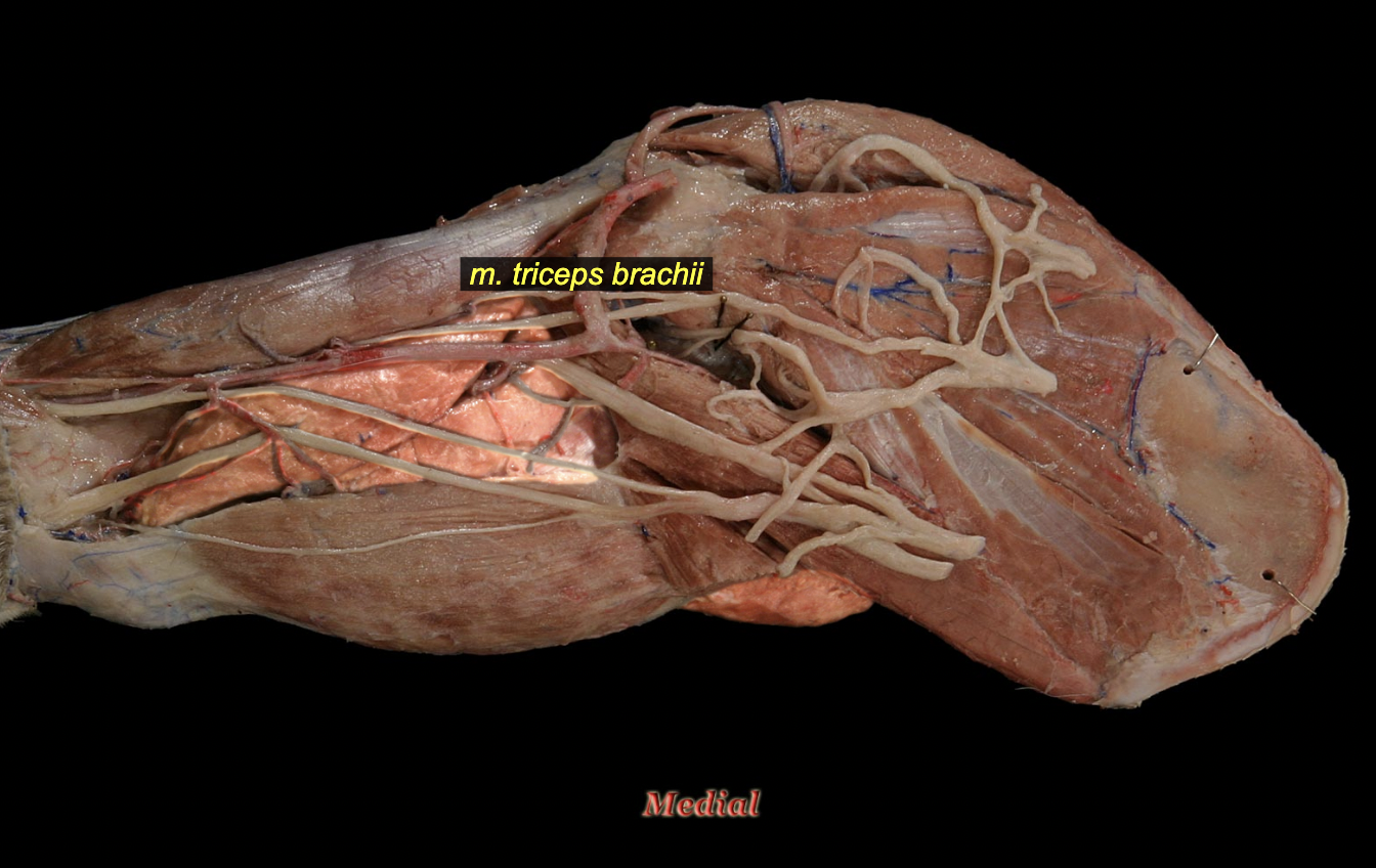 <p><span>O: </span><strong>long head</strong><span>: caudal border of scapula; </span><strong>lateral head</strong><span>: tricipital line of humerus; </span><strong>accessory head</strong><span>: neck of humerus; </span><strong>medial head</strong><span>: crest of lesser tubercle</span><br><span>I: olecranon</span><br><span>A: shoulder flexion (long head only) and extension of elbow</span><br><span>N: radial n.</span></p>