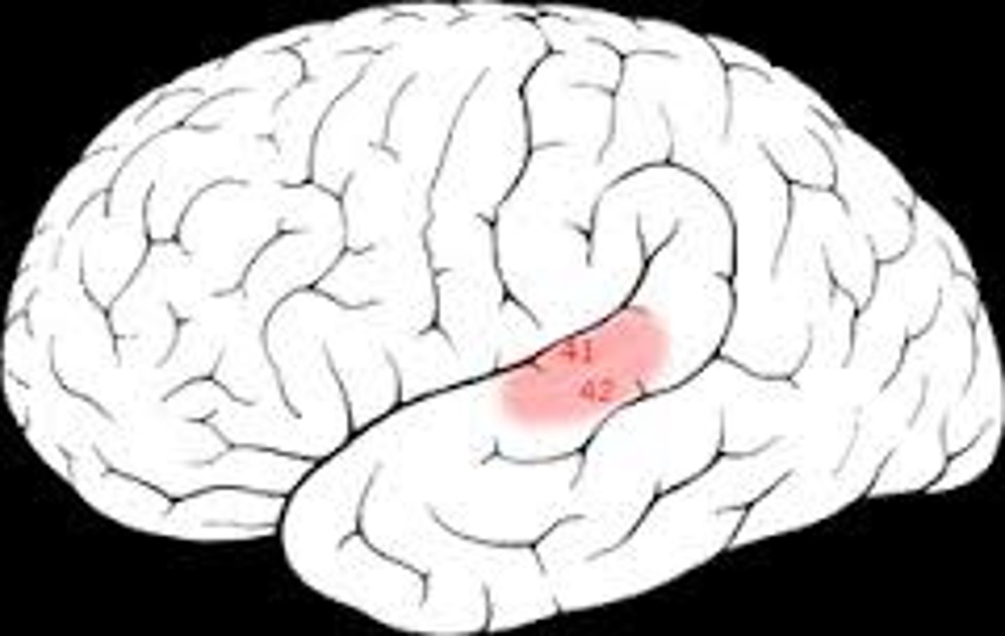<p>cortex of the temporal lobe responsible for processing sound information</p>