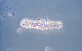 <p>Identify the urine sediment element shown and what perspective it is in</p>