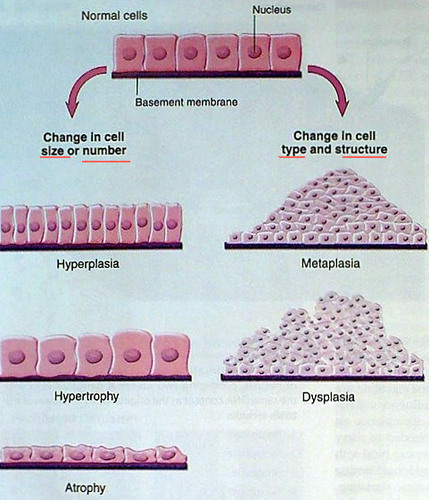 <p>increase in number of cells</p>