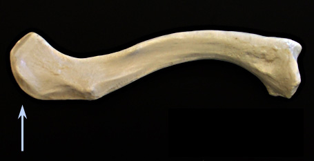 <p>(left clavicle)</p>