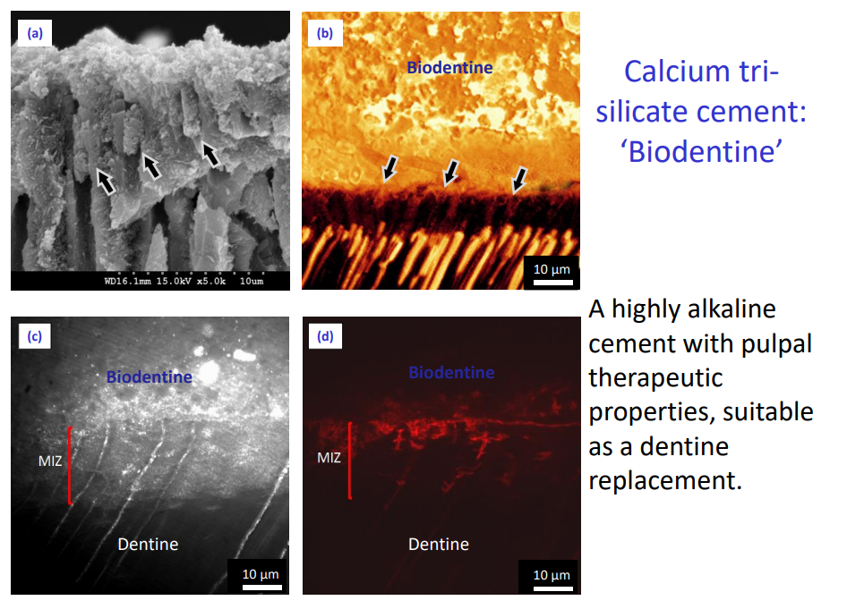 <p>A highly <strong>alkaline</strong> cement with pulpal <strong>therapeutic properties</strong>, suitable as a<strong> dentine replacement.</strong></p>