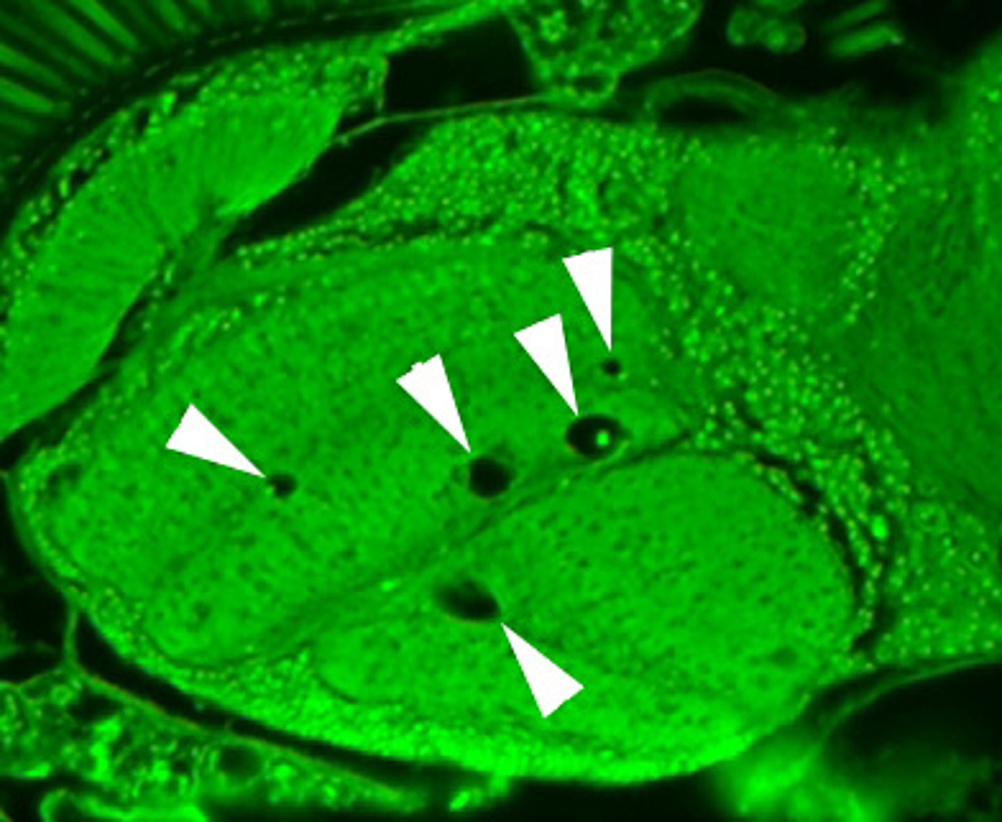 <p>Large saclike, membrane-enclosed structures that store materials like salts, proteins, and carbohydrates.</p>
