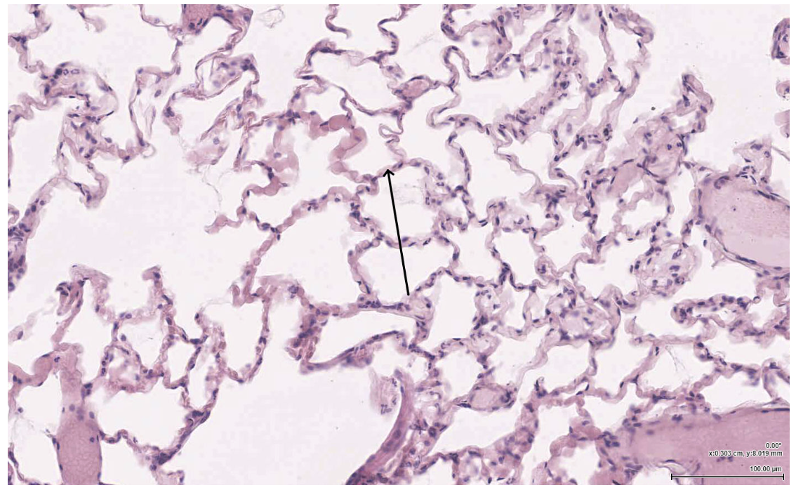 <p><span><span>The structure indicated by the arrow most likely contains which of the following:</span></span></p>